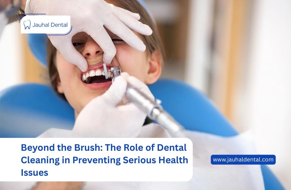 Beyond the Brush: The Role of Dental Cleaning in Preventing Serious Health Issues
