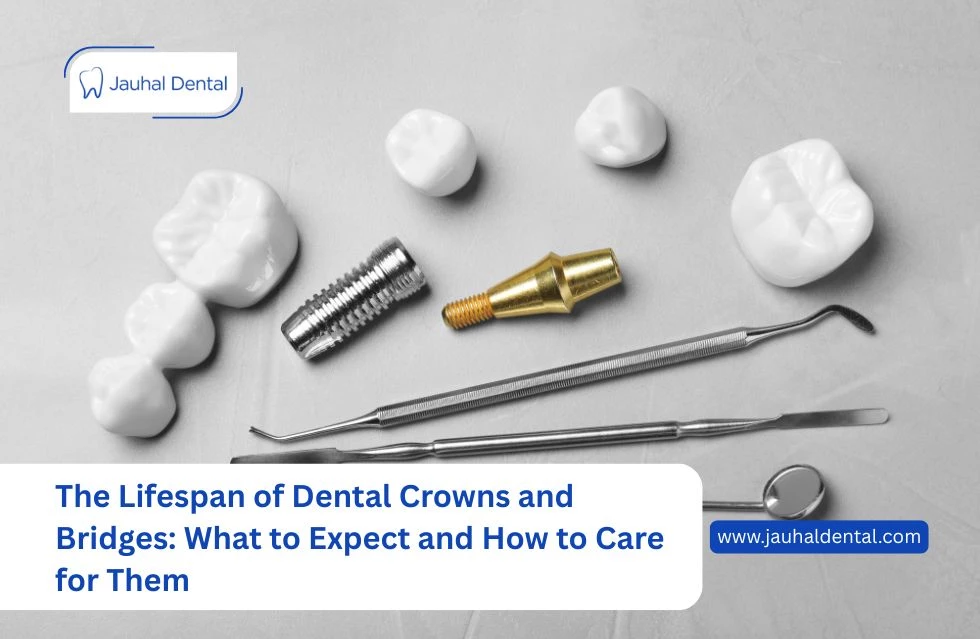 The Lifespan of Dental Crowns and Bridges: What to Expect and How to Care for Them