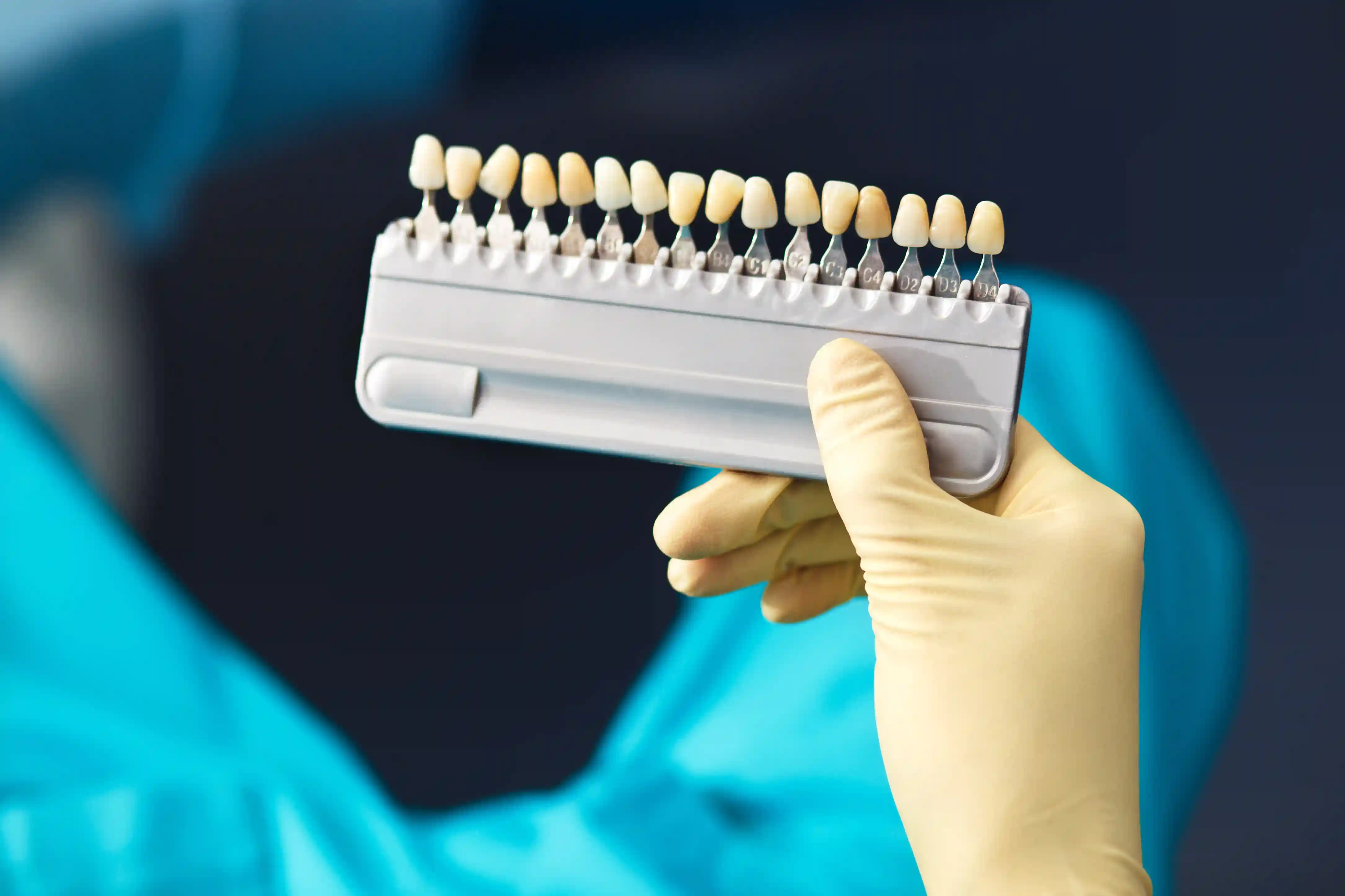 Porcelains Crowns Mississauga